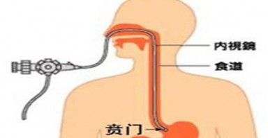 消化道出血早期的症状，脓血便和粘液血便图片